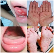 1725497698350017090.png image.png